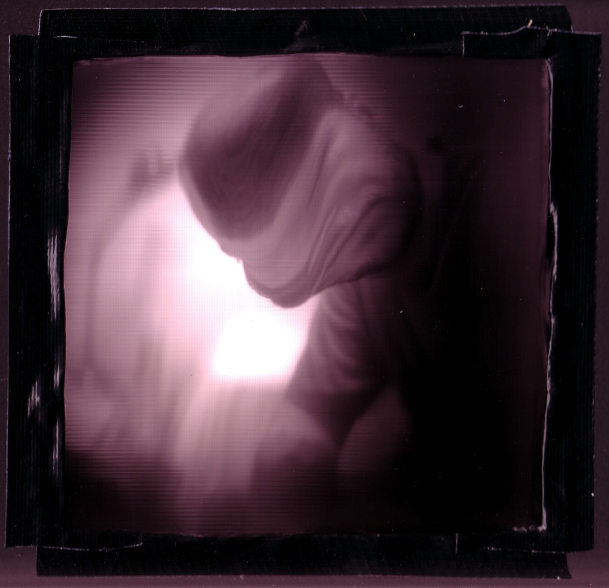 Moving my head during the scan created this garbled effect